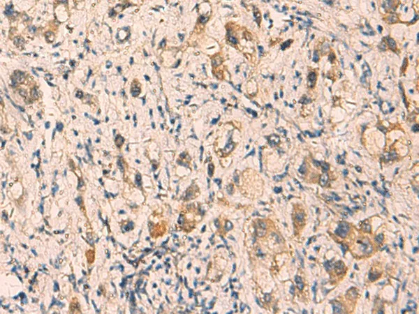 CRYM Polyclonal Antibody - image 1
