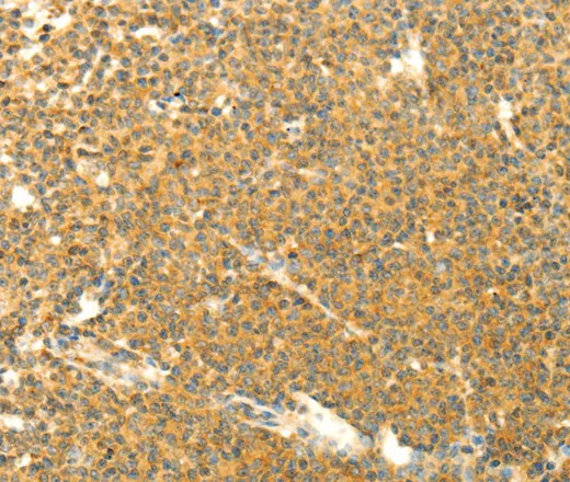 AARS2 Polyclonal Antibody - image 1