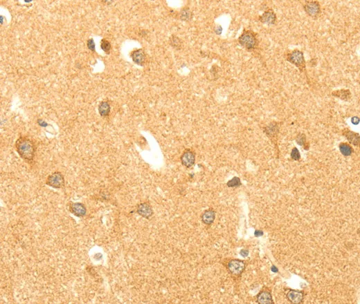 AARS2 Polyclonal Antibody - image 2