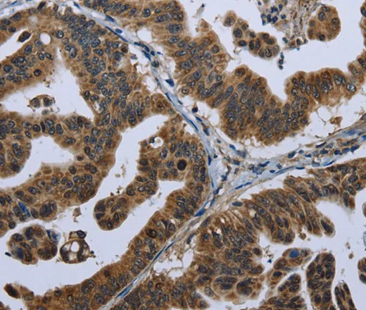 GPAM Polyclonal Antibody - image 1