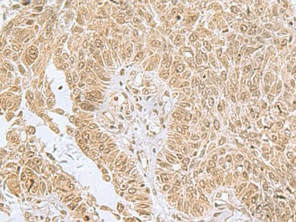 PHF6 Polyclonal Antibody - image 1