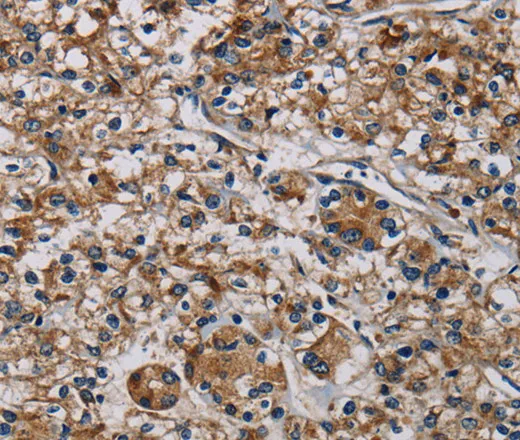 PLIN3 Polyclonal Antibody - image 1