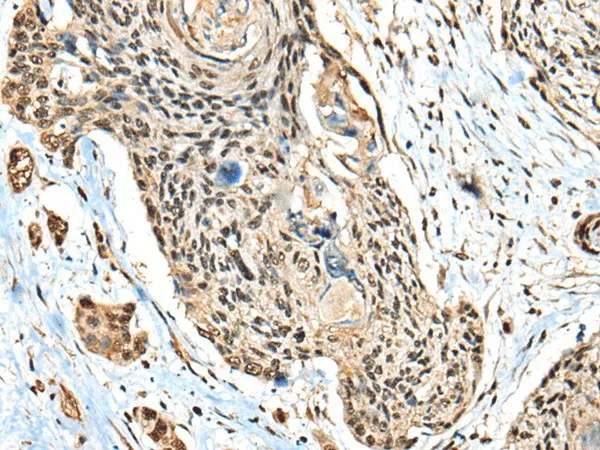 CBFB Polyclonal Antibody - image 1