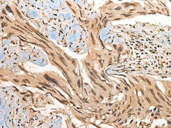 CBFB Polyclonal Antibody - image 2