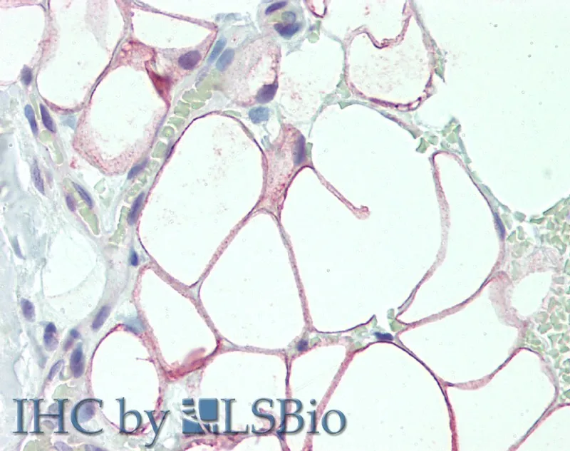 DCBLD2 Polyclonal Antibody - image 2