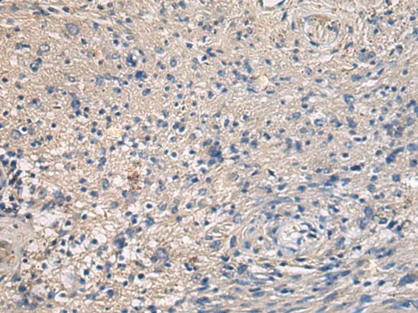 MAPKAPK3 Polyclonal Antibody - image 1
