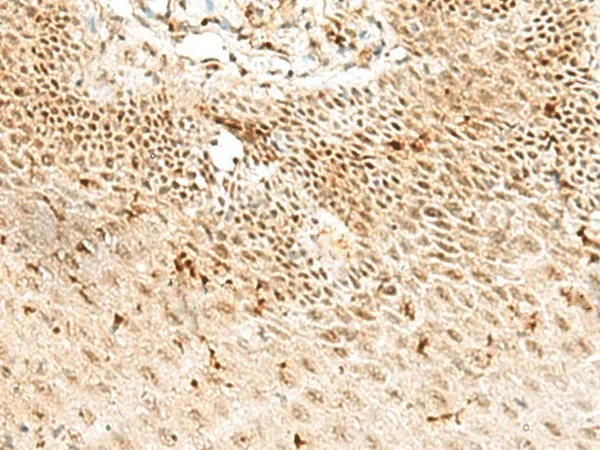 RBM10 Polyclonal Antibody - image 1