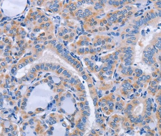 CD36 Polyclonal Antibody - image 1