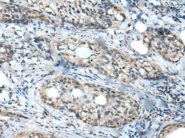 WDFY2 Polyclonal Antibody - image 1