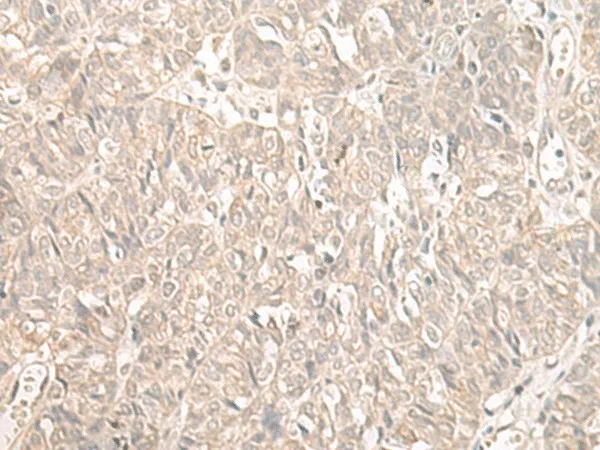 ILKAP Polyclonal Antibody - image 1