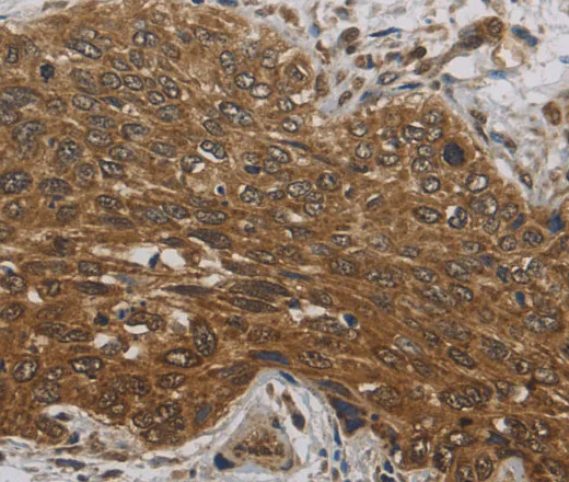 DCTN3 Polyclonal Antibody - image 1
