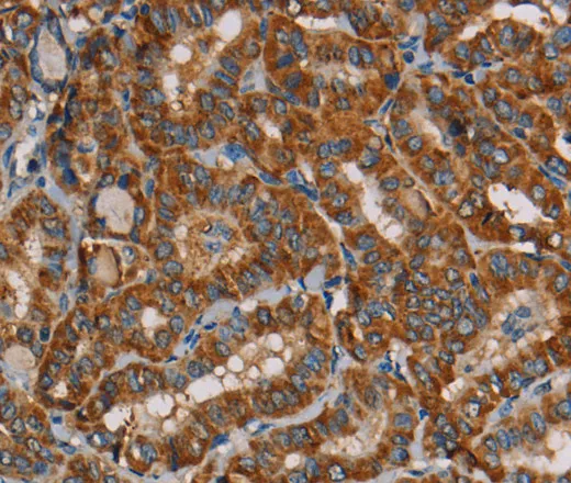 MRPL39 Polyclonal Antibody - image 1