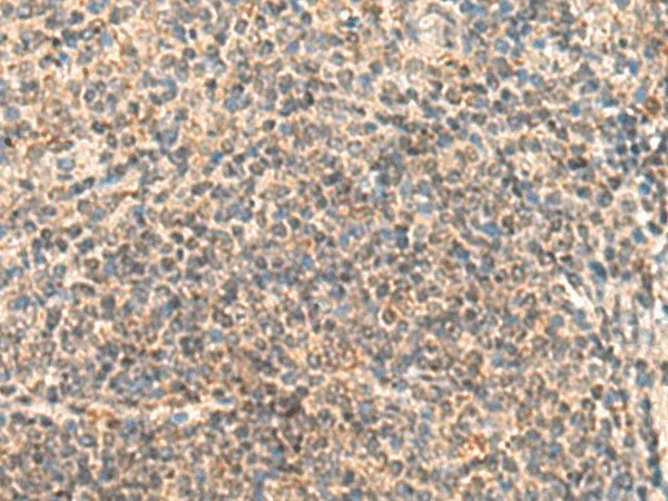 IDUA Polyclonal Antibody - image 1