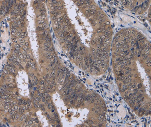 CDK5 Polyclonal Antibody - image 1