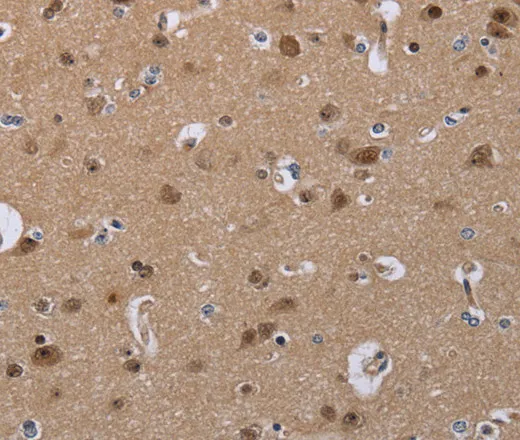 CDK5 Polyclonal Antibody - image 2