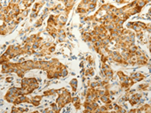 VDAC2 Polyclonal Antibody - image 1