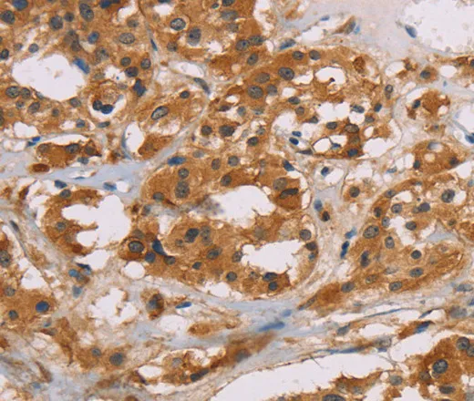 CD22 Polyclonal Antibody - image 1