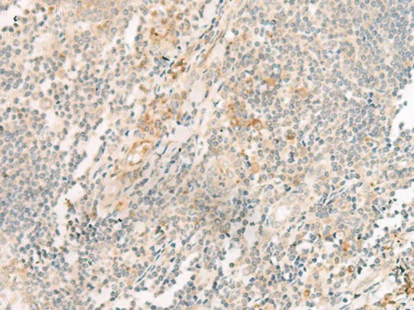 HBE1 Polyclonal Antibody - image 1