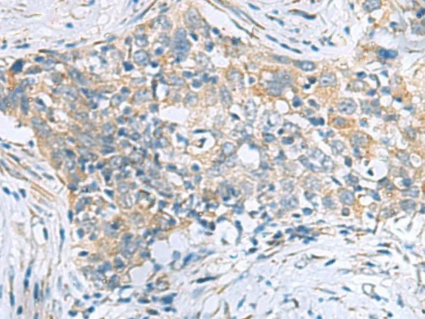 PPIC Polyclonal Antibody - image 1