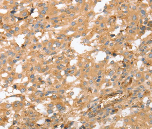 AHSG Polyclonal Antibody - image 1