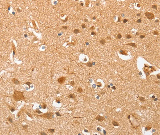 AHSG Polyclonal Antibody - image 2
