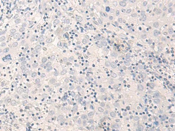 THOP1 Polyclonal Antibody - image 1