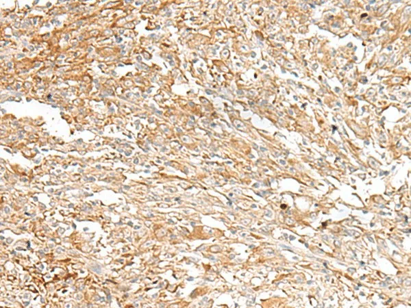 IBSP Polyclonal Antibody - image 1