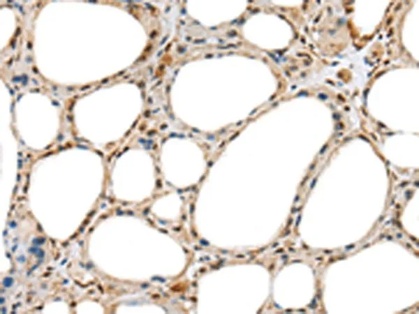 RAB11A Polyclonal Antibody - image 1