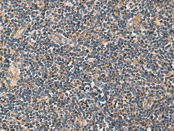 PDHA1 Polyclonal Antibody - image 1