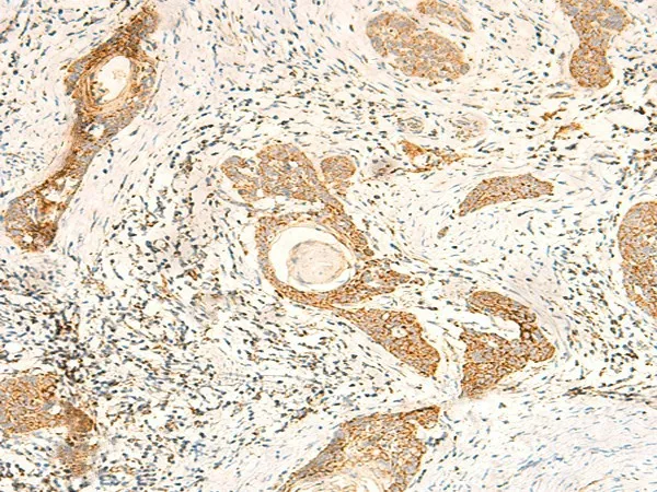 MT-CO2 Polyclonal Antibody - image 1