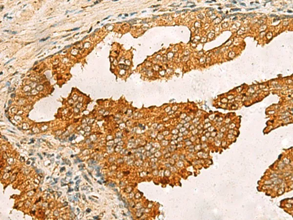 BECN1 Polyclonal Antibody - image 1