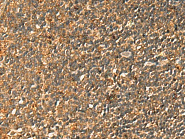 BECN1 Polyclonal Antibody - image 2