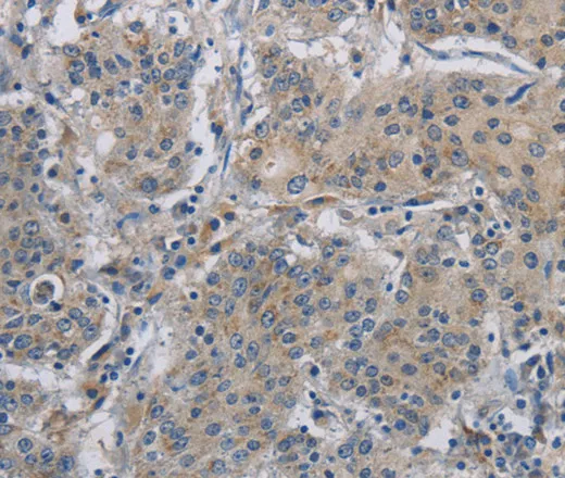 DNAJB4 Polyclonal Antibody - image 1
