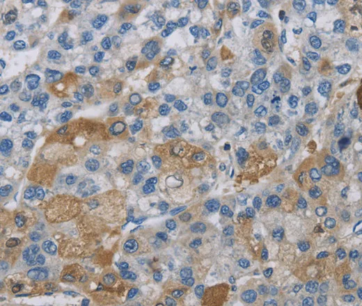 DNAJB4 Polyclonal Antibody - image 2