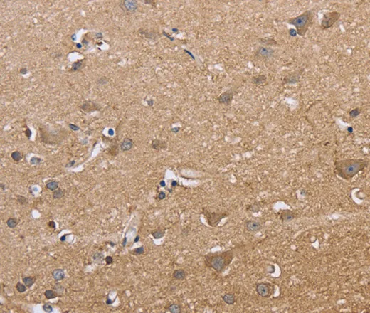 MAPRE3 Polyclonal Antibody - image 1