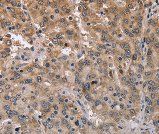 MAPRE3 Polyclonal Antibody - image 2