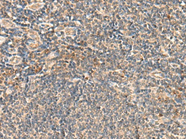 SEC22B Polyclonal Antibody - image 1