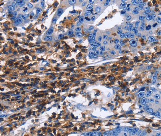 CD45 Polyclonal Antibody - image 1