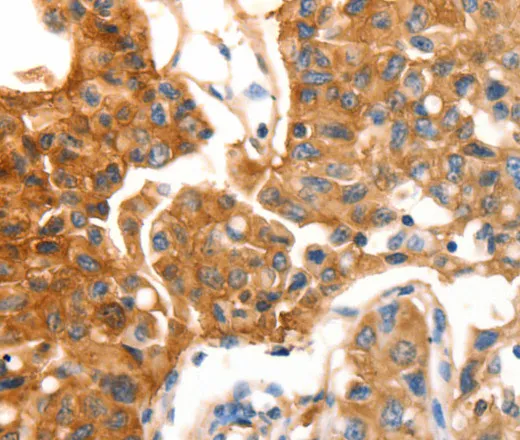 MVP Polyclonal Antibody - image 1