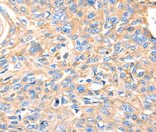 MVP Polyclonal Antibody - image 2