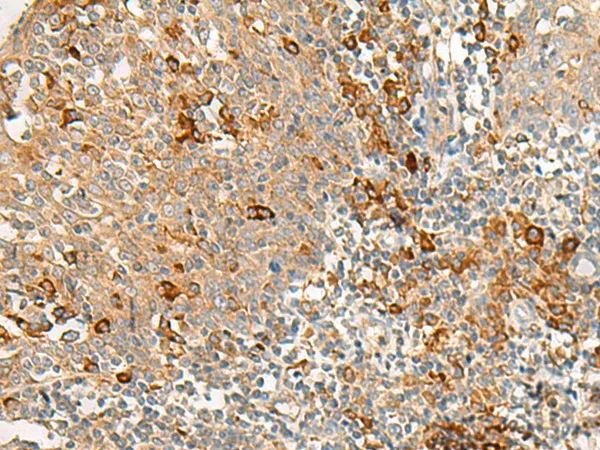 RNF207 Polyclonal Antibody - image 1