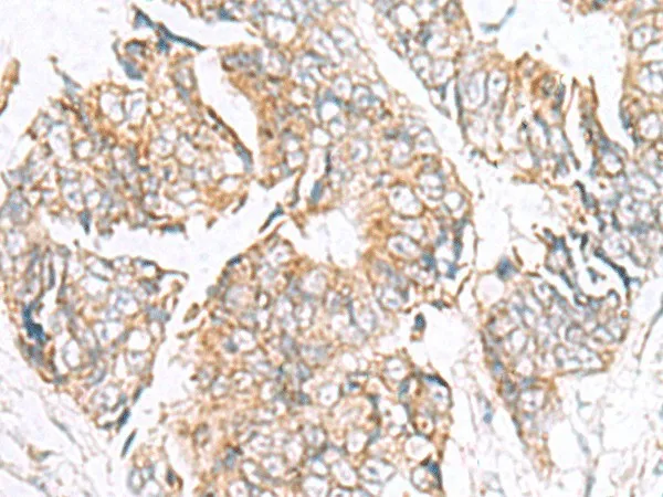 GPC2 Polyclonal Antibody - image 1