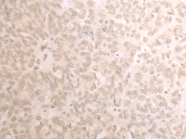 TRMT1 Polyclonal Antibody - image 1