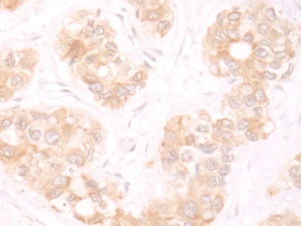 TRMT1 Polyclonal Antibody - image 2