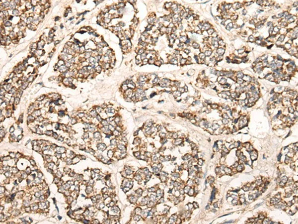C1S Polyclonal Antibody - image 1