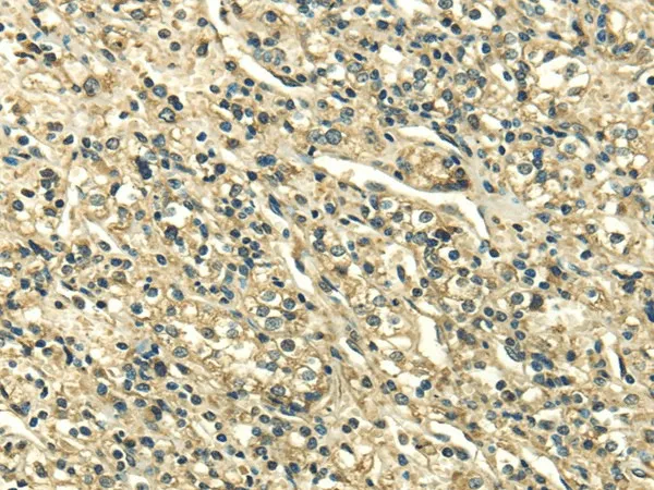 SDF4 Polyclonal Antibody - image 1