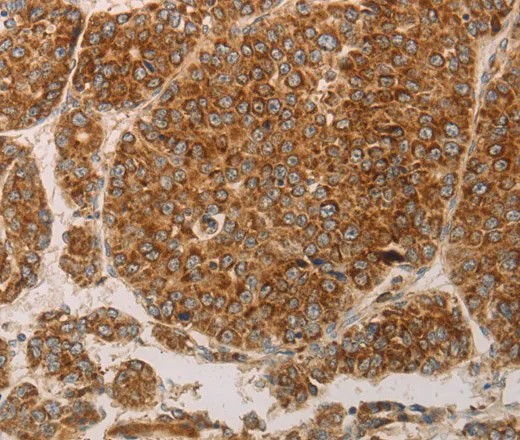 PRDX3 Polyclonal Antibody - image 1