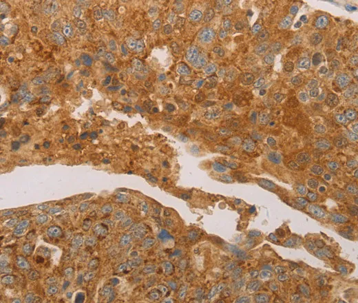 PRDX3 Polyclonal Antibody - image 2