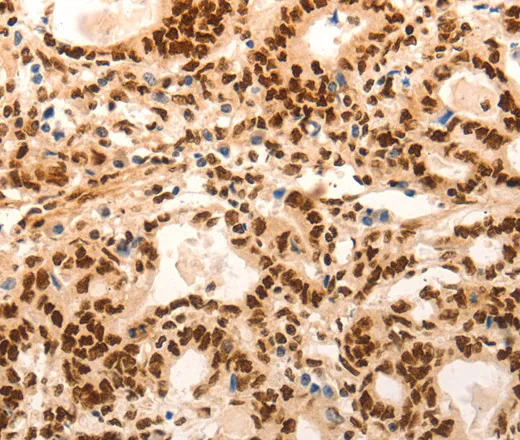 E2F7 Polyclonal Antibody - image 1