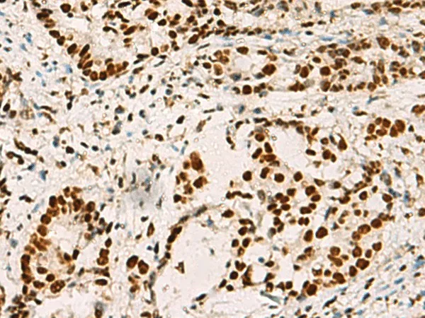 ELF5 Polyclonal Antibody - image 1